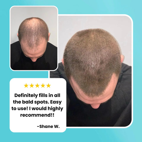 SURETHIK Hair Thickening Fibers - DK BEAUTY
