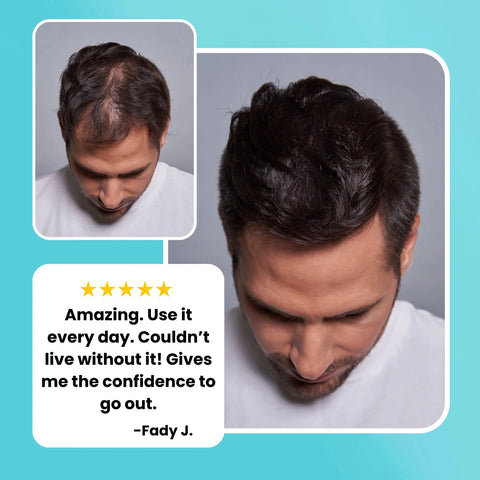 SURETHIK Hair Thickening Fibers - DK BEAUTY