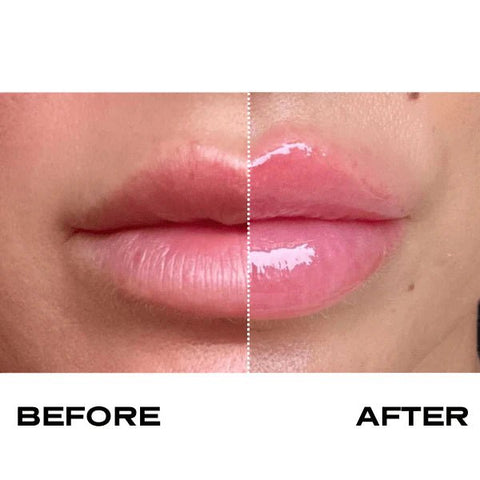 Plump It! No Needles Lip Filler Kit Original - DK BEAUTY
