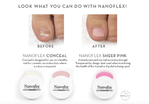 NanoFlex Starter Kit - Proof of Training Required - DK BEAUTY