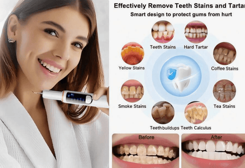 Hyundai Advanced Electric Tooth Cleaning Tool - DK BEAUTY
