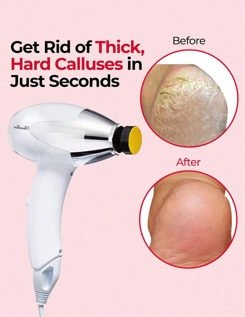 OlaSalon Electric Foot Callus Remover – 12 Sanding Attachments