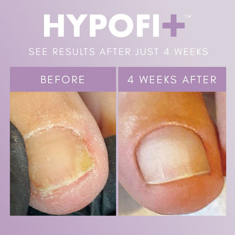 TGB HypoFix™ Primer - DK BEAUTY