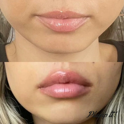 Plump It! Volumising Lip Plumper (Tingle) - DK BEAUTY