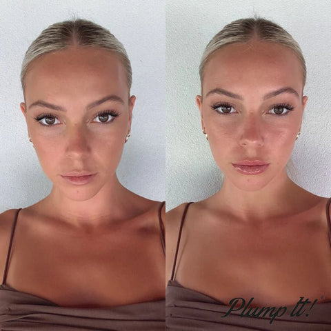 Plump It! No Needles Dermal Filler (30 applications) - DK BEAUTY