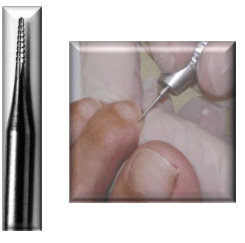 NASP Ingrown Toe Nail Bit (2 Pack) - DK BEAUTY