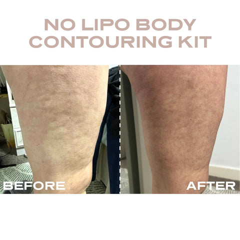 Plump It! Body Contour Kit