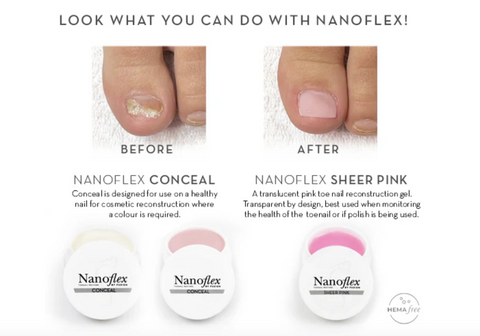 NanoFlex Gel Toe Nail Reconstruction Kit