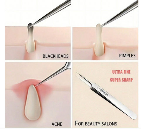 Extremely Pointed Tip Tweezers for Blackheads