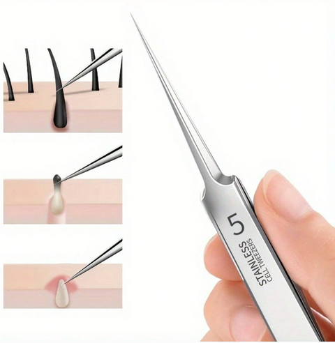 Extremely Pointed Tip Tweezers for Blackheads