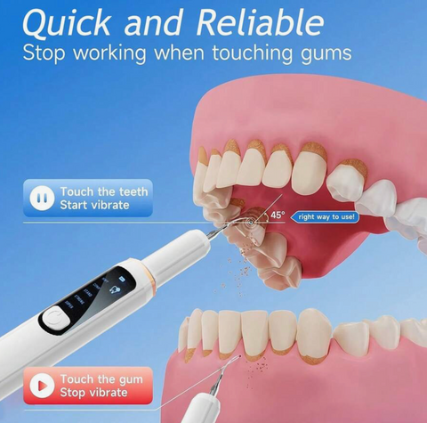 Hyundai Advanced Electric Tooth Cleaning Tool
