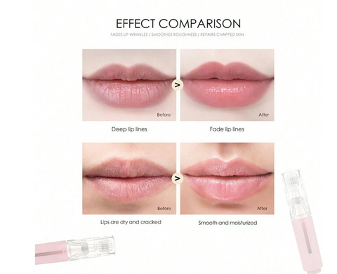 Microneedling, PMU & Mesotherapy