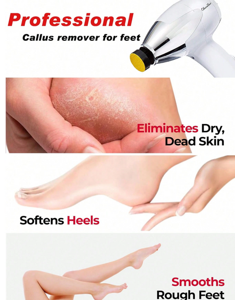 OlaSalon Electric Foot Callus Remover – 12 Sanding Attachments