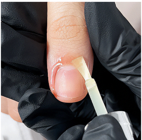 TGB MAN-icure Basic Bundle