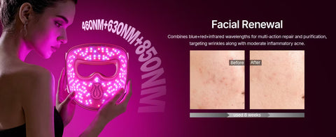 Hello Face 4D Red Light Therapy Mask