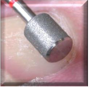 NASP Nail Plate Diamond Fine Side Grip Bit