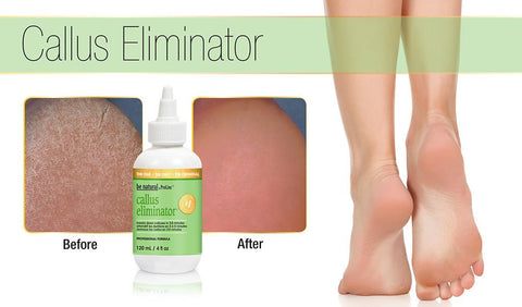 Be Natural Callus Eliminator 18oz - DK BEAUTY